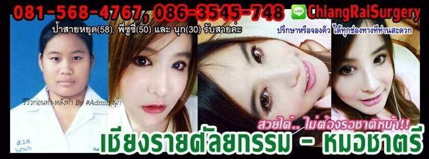 10 คลินิกศัลยกรรมคาง หน้าสวย ได้สัดส่วน มีมิติในราคาสบายกระเป๋า 8 รีวิวเสริมคาง
