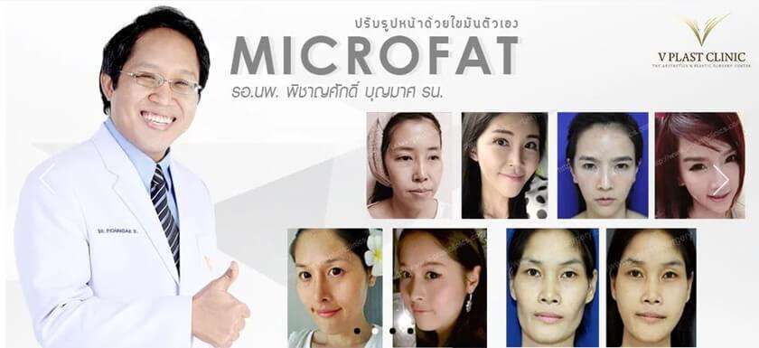 ฉีดสะโพก หมอเทพ
