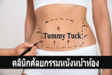 10 คลินิกศัลยกรรมหนังหน้าท้อง แก้ไขหน้าท้องย้วย ให้กระชับแบนราบ โดยแพทย์ผู้เชี่ยวชาญ