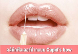 10 คลินิกฟิลเลอร์ปากแบบ Cupid’s bow สร้างเสน่ห์ดูดี รีวิวเลิศ ราคาเอื้อมถึง