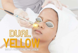 10 ร้านคลินิกเลเซอร์ Dual Yellow Laser ลบริ้วรอยเพิ่มความกระจ่างใสได้ดีที่สุด 2026