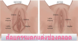 10 คลินิกรีแพร์ ศัลยกรรมช่องคลอด ให้ฟิตดั่งสาวแรกรุ่น โดยแพทย์ผู้เชี่ยวชาญ 2026